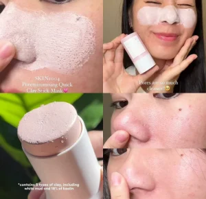 ماسک استیکی کنترل منافذ خاک رس سنتلا اسکین 1004